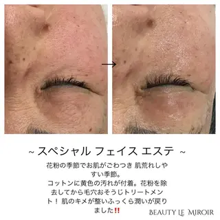 ビューティー ミロワールのエステ・リラクイメージ