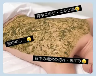 ベラージュ【美背中・ 美尻・フェイシャル】のエステ・リラクイメージ