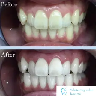 セルフホワイトニングサロンfascimo所属・ホワイトニングサロン fascimo新座店のその他イメージ