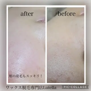 Lutella所属・ワックス脱毛専門店 Lutellaのエステ・リラクイメージ