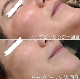 BEAUTYSARON　SiS.所属・高橋 沙奈江のエステ・リラクイメージ