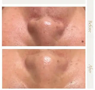 ピーリング＆脱毛 maoのエステ・リラクイメージ