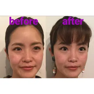 隆鼻矯正専門店ラプリ 田口のエステ・リラクイメージ