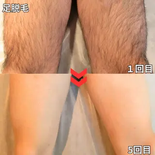 メンズ 都度払い制メンズ脱毛 オーナーのエステ・リラクイメージ