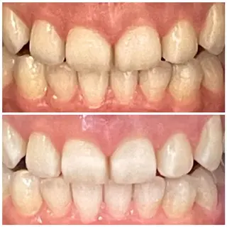 DIAMOND BEAUYのその他イメージ