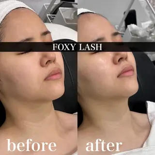 FOXYLASH inoueのエステ・リラクイメージ