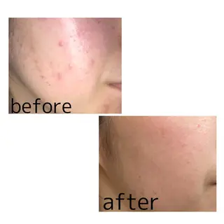 Belchic ベルシックのエステ・リラクイメージ