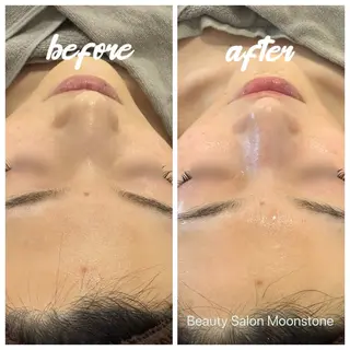 Moonstone 腸活ダイエット・脱毛のエステ・リラクイメージ