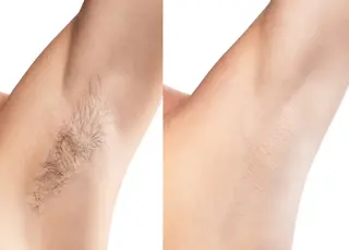 il SOLEのエステ・リラクイメージ