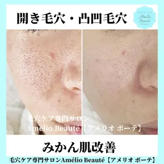 毛穴ケア専門サロン アメリオボーテのその他イメージ