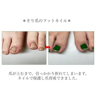 ネイル ネイルサロン アリュームのネイルデザイン
