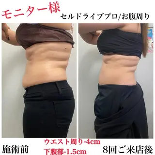 エステサロン Venusのその他イメージ