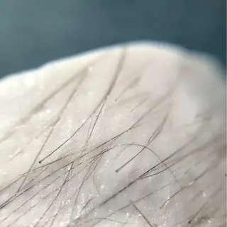 代表 MOMOのエステ・リラクイメージ