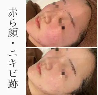 ハーブピーリング専門 BIOPLUS+川崎のエステ・リラクイメージ