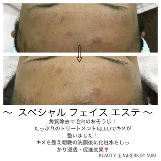 ビューティー ミロワールのエステ・リラクイメージ