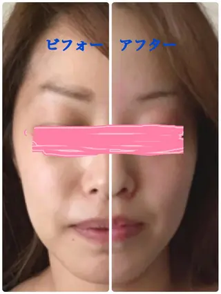 小顔サロン ソ.ルシエのエステ・リラクイメージ