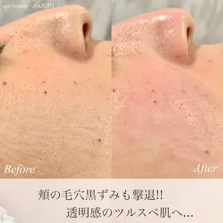 脱毛&ビューティー A'nJUDYの眉毛・アイブロウイメージ