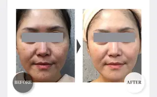 HappIness 遠赤外線ドームのエステ・リラクイメージ