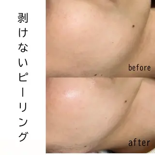 メンズ 歌舞伎町深夜サロン to mëのエステ・リラクイメージ