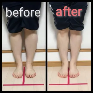 小顔と姿勢改善のプロ ｜整体と美容鍼のぐちのエステ・リラクイメージ