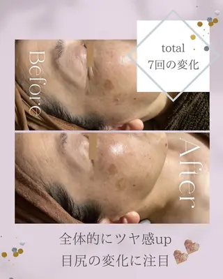 ainoa所属・ainoa アイノアのエステ・リラクイメージ