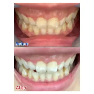 Ｍ渋谷 ホワイトニングのエステ・リラクイメージ