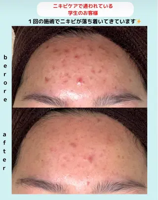 ベラージュ【美背中・ 美尻・フェイシャル】のエステ・リラクイメージ