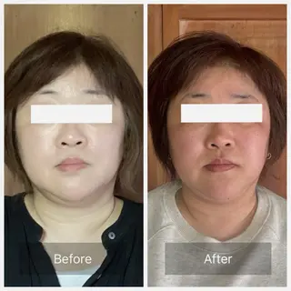 ルコナビューティ所属・小顔・歪み専門　井元 朋子のエステ・リラクイメージ