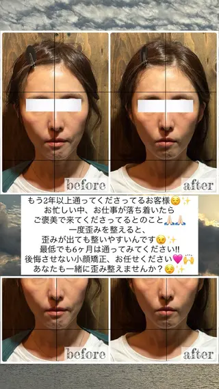 💎後悔させない小顔 矯正💎イトヤマ🌱のエステ・リラクイメージ