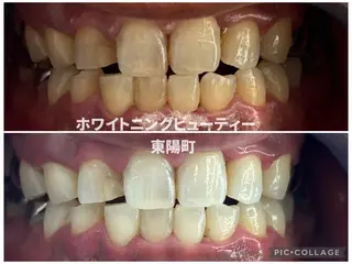 ホワイトニングビューティー東陽町店所属・ホワイトニング ビューティー東陽町店のその他イメージ