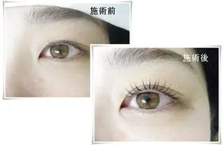 マツエク・マツパ エステサロンジョイエ所属・大部 桂子のエステ・リラクイメージ