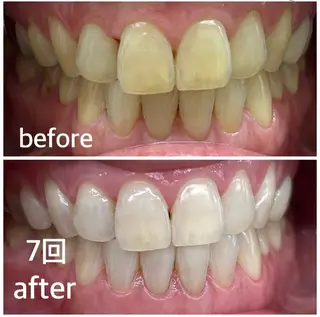 ホワイトニング・ハーブピーリング・フェイシャルサロンSUN所属・SUN MIWAのエステ・リラクイメージ