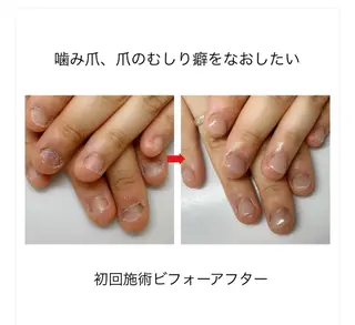 ネイル ネイルサロン アリュームのネイルデザイン