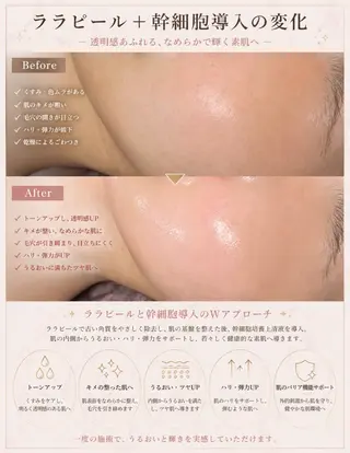 美肌・小顔専門🪄 看護師施術/松﨑のエステ・リラクイメージ