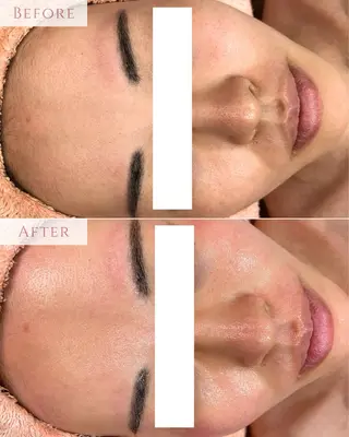 肌質改善専門サロン Bellmi/心斎橋のエステ・リラクイメージ