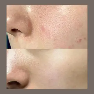 愛維美水光美肌専門店所属・愛維美水光美肌専門店 メンズレディースokのエステ・リラクイメージ