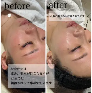 Lash One 四条店のマツエク・マツパデザイン