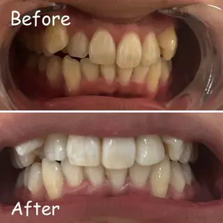 メンズ エマニエル USAのエステ・リラクイメージ