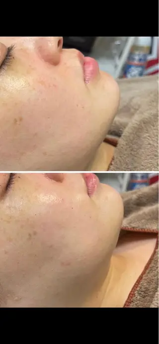 リーズナブル光脱毛サロンOhana所属・永吉 ゆかりのエステ・リラクイメージ