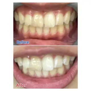 M渋谷店所属・M渋谷 ホワイトニングのエステ・リラクイメージ