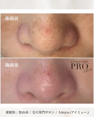 毛穴専門店アイミュー mamiのエステ・リラクイメージ