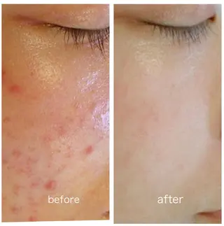 SMOOTH SKIN SPA.のエステ・リラクイメージ