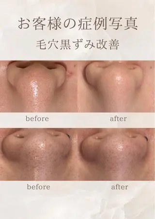 pansy(パンジー)上野フェイシャルエステ専門店所属・pansy フェイシャルエステのエステ・リラクイメージ