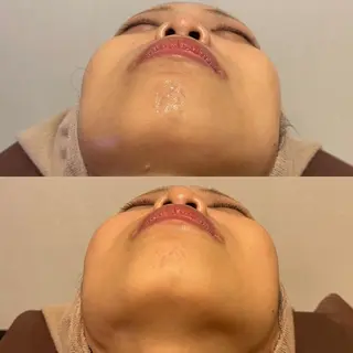 アイブロウ Epina 千葉店 【エピナ】のエステ・リラクイメージ