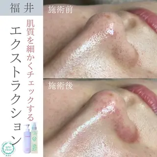 毛穴肌質ケアサロン Yourmeユアミーのエステ・リラクイメージ