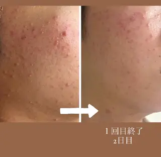 sbeaute  エスボーテのエステ・リラクイメージ