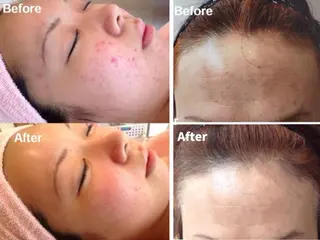 イルミナ 伊藤のエステ・リラクイメージ