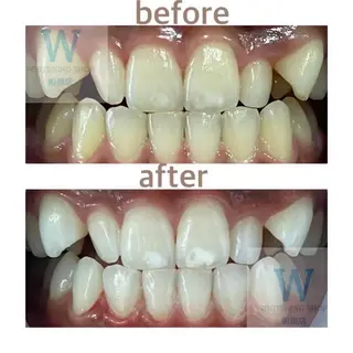 ホワイトニング ショップ船橋２号店のエステ・リラクイメージ