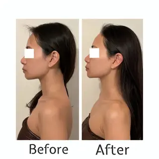 【医療提携】脱毛 小顔ハーブピーリングのエステ・リラクイメージ