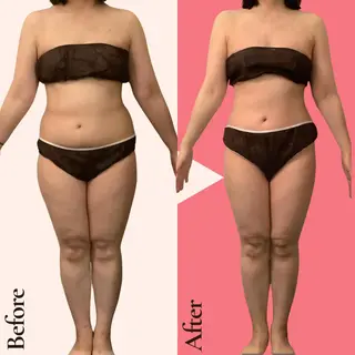 痩身ダイエット専門店 プレシャスのエステ・リラクイメージ